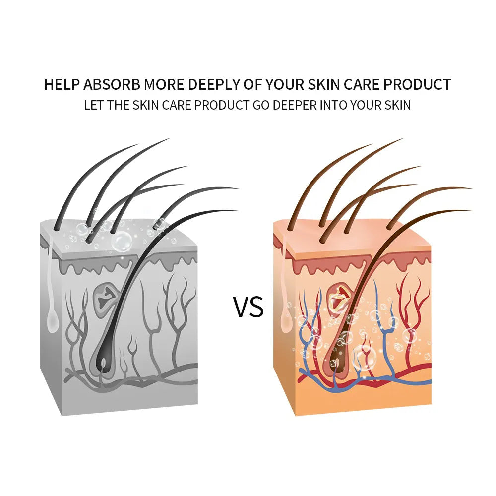 NNEOBA 4-in-1 RF Face Lifting Machine: EMS, Micro-current, LED Photon, and Massager for Facial Rejuvenation